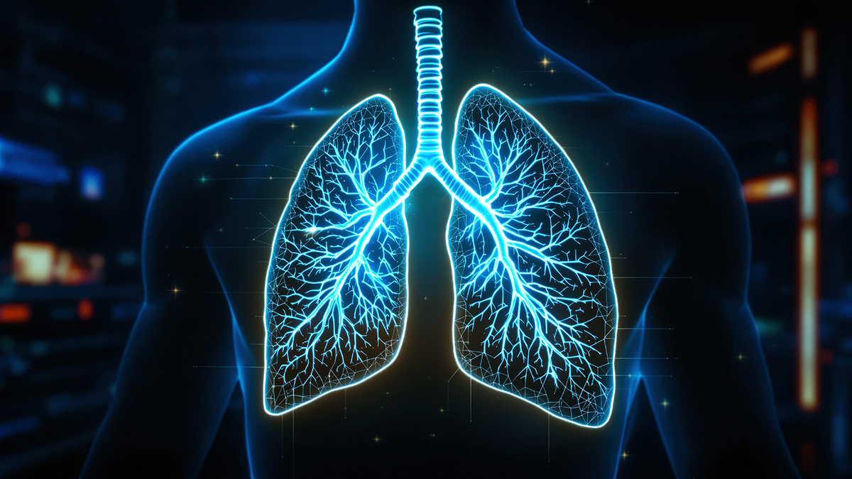 BARDA RFI ARDS Prevention