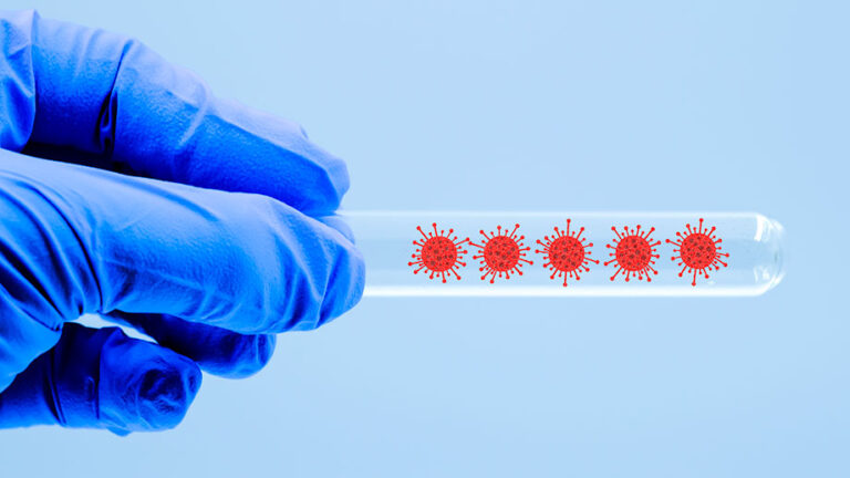 immunoassay IEID Lab Solicitation