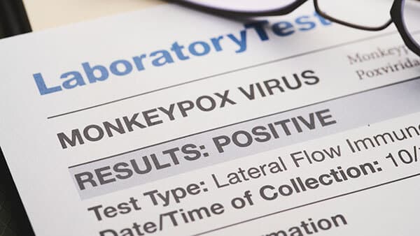 Monkeypox Virus declared a Public Health Emergency
